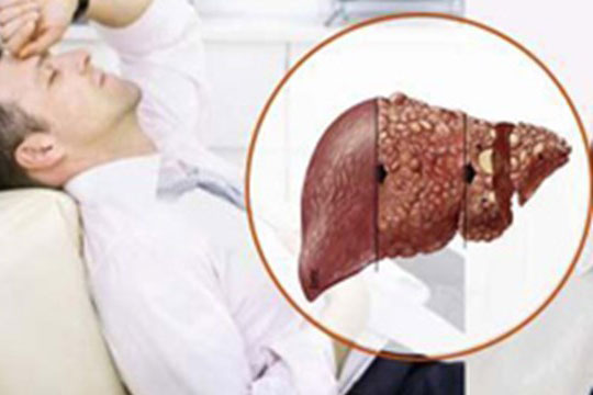 Benh Viem Gan B Man Tinh Khong Cotac Nhan Delta La Gi 1